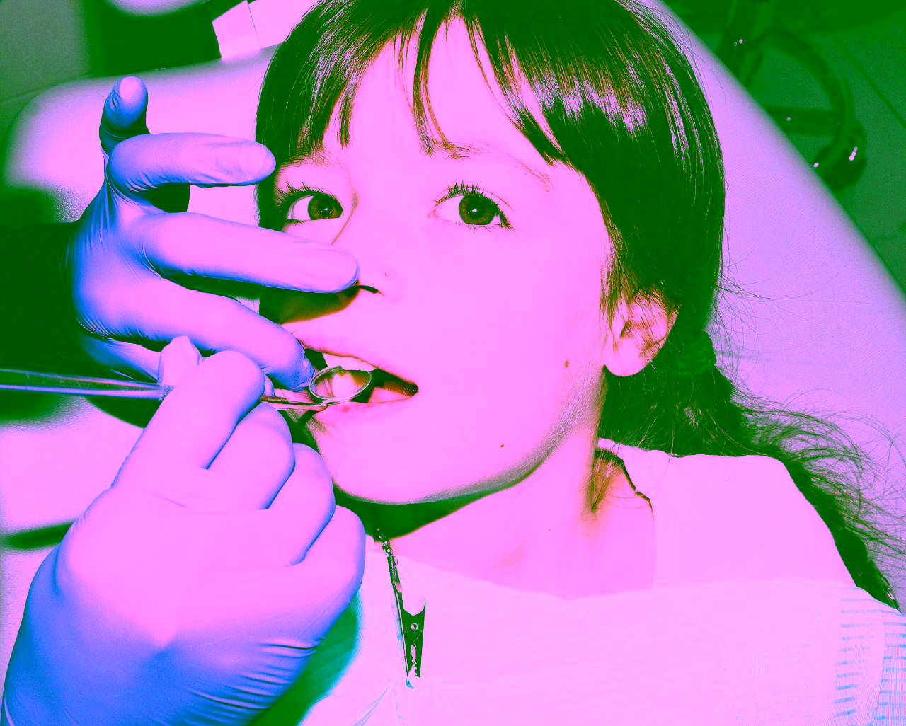 лечение зубов у детей