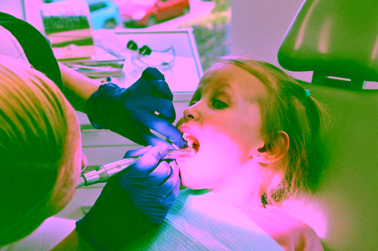 герметизация фиссур у детей