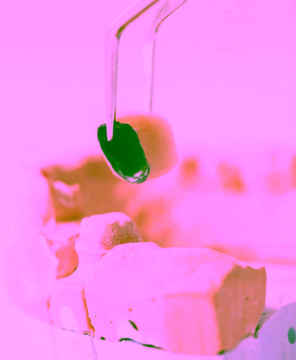 металокерамічна коронка