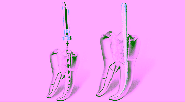 Лечение корневых каналов