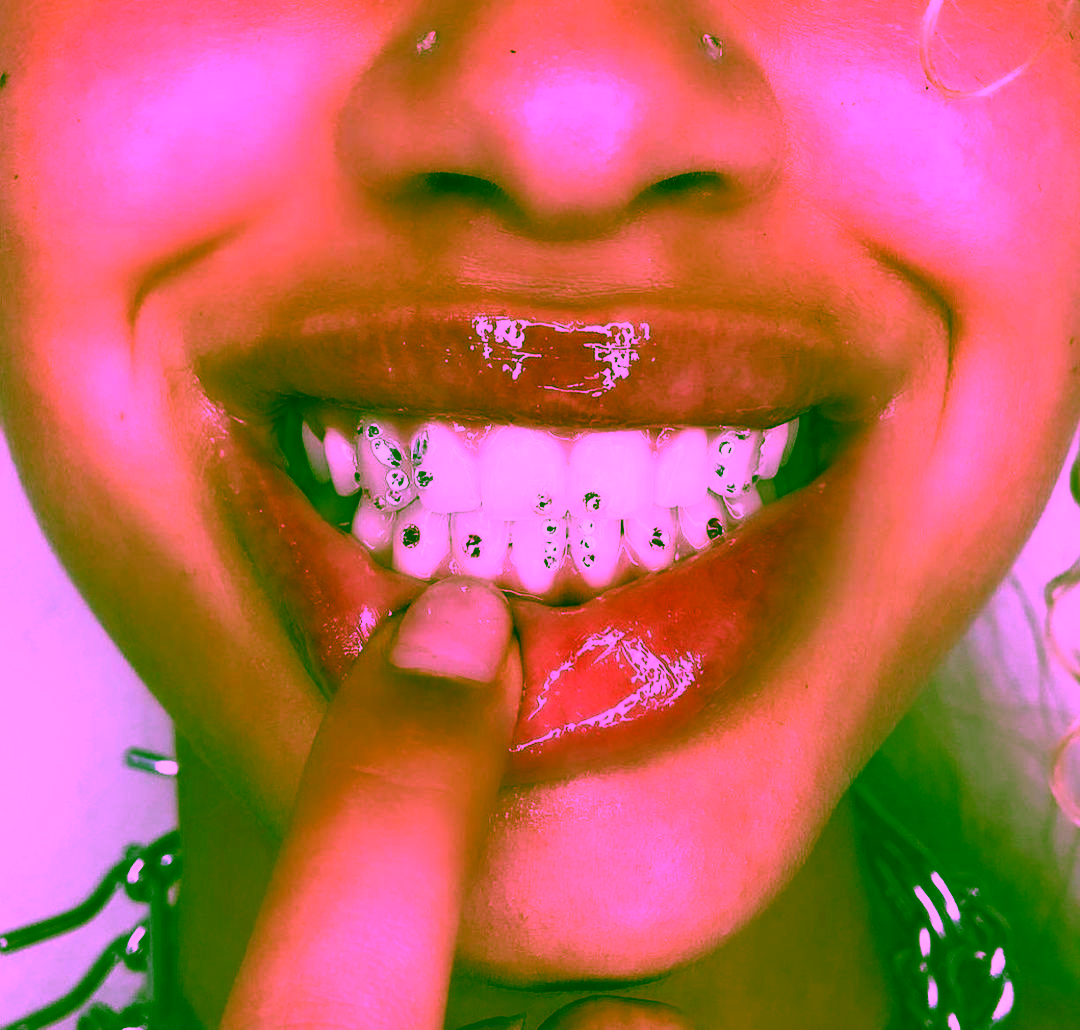 скайсы на зубах - фото украшения зубов