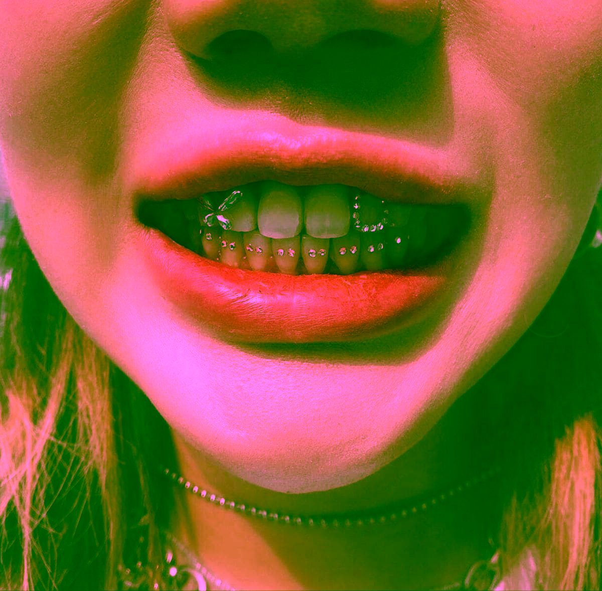 скайси на зубах - прикраси для зубів