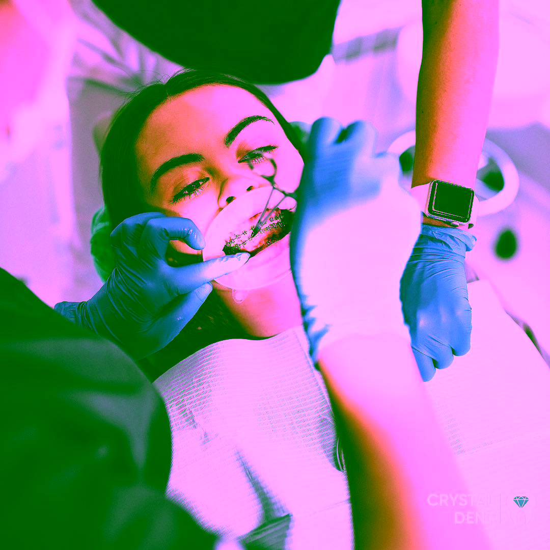 установка брекетов Киеве