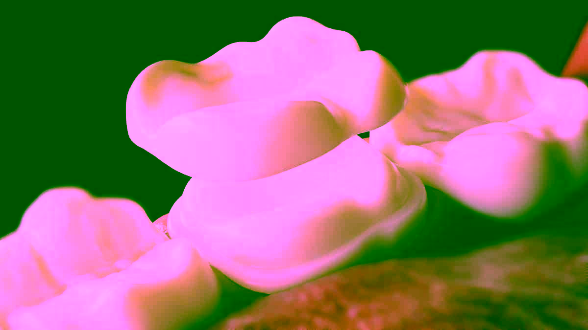 микропротезування - київ