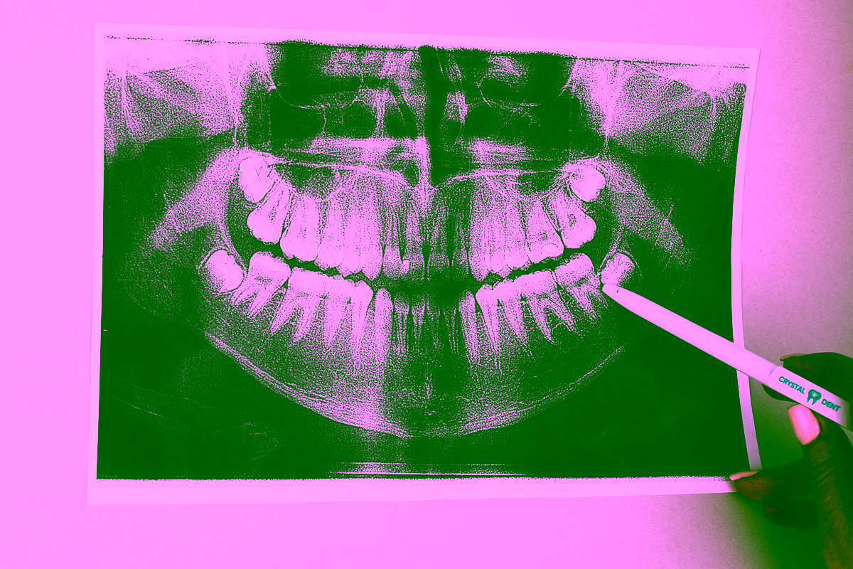 ренген зубів у києві