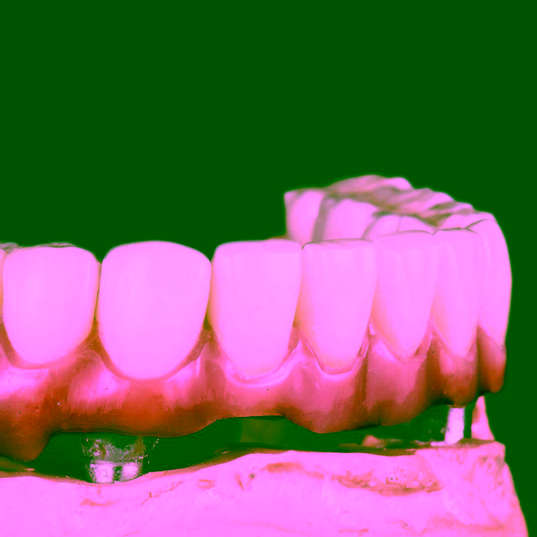 Все на 4 или все на 6