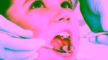 Лечение зубов у детей