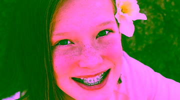 Коррекция прикуса у детей