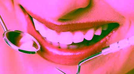 Индивидуальная гигиена полости рта