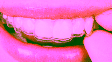 Инвизилайн