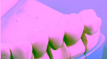 Зубные коронки