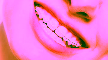 Сапфировые брекеты