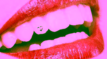 Скайсы или украшения зубов