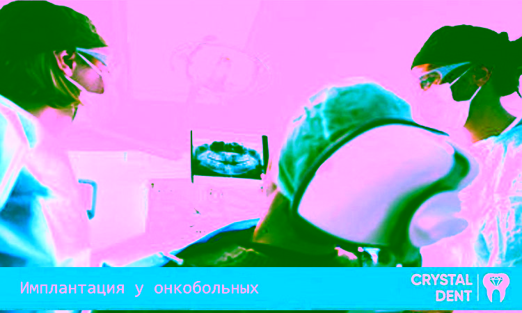 Особенности имплантации зубов у онкобольных