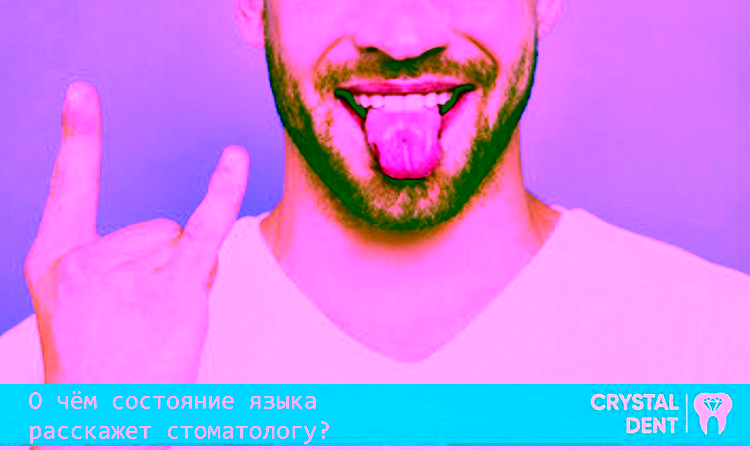 Хвороби язика, які може розпізнати стоматолог