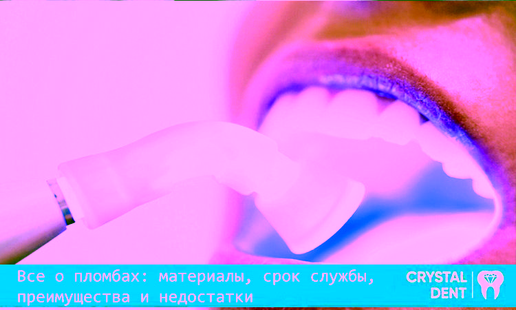 Все про пломби: матеріали, термін служби, переваги і недоліки