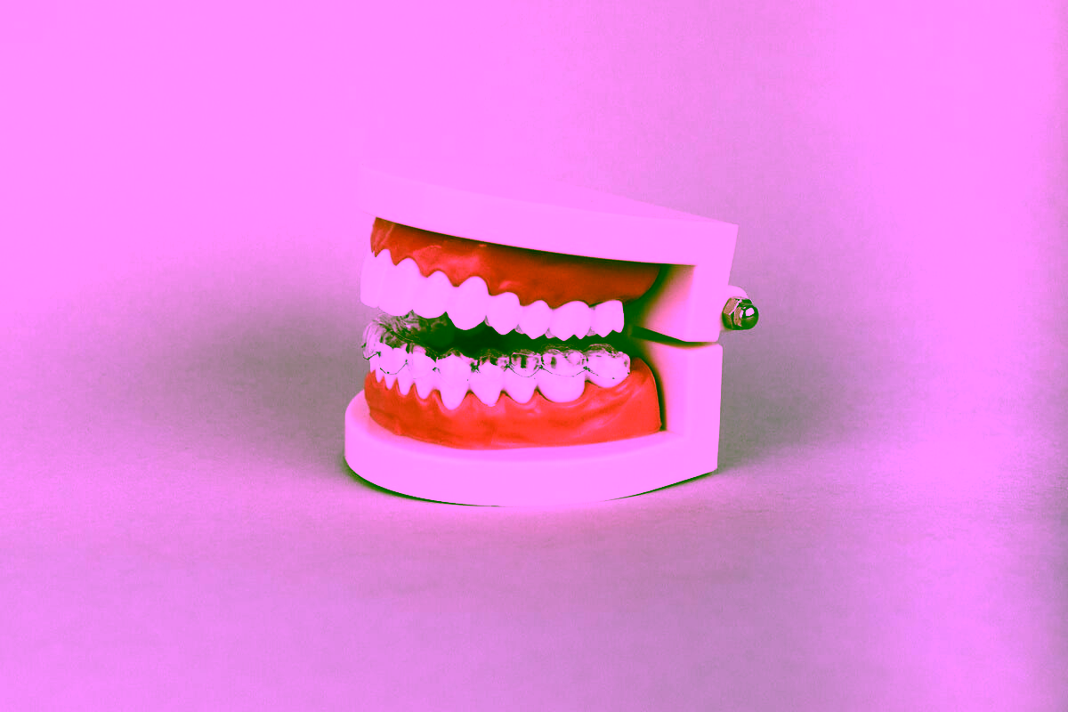 Классификация кариеса по Блэку: полное описание системы