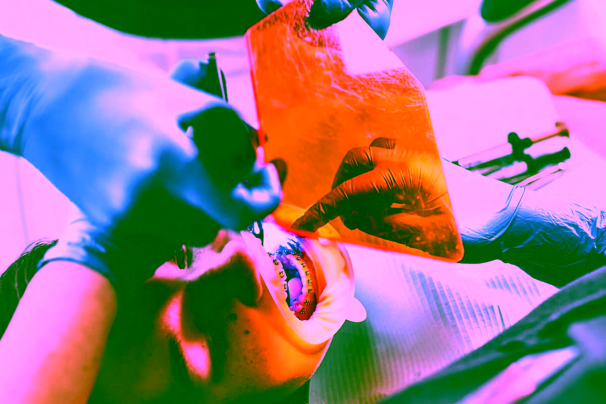 Резинки на брекеты – важная часть ортодонтической конструкции