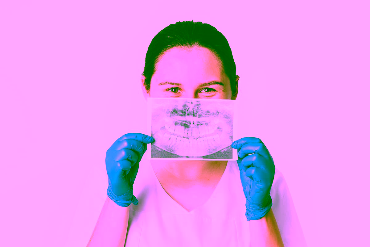 Пародонтоз: причины и методы лечения