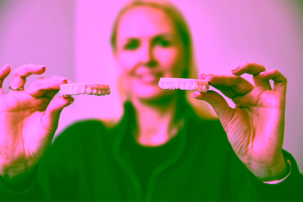 Элайнеры: что это такое, показания, противопоказания к применению, преимущества и недостатки приспособлений