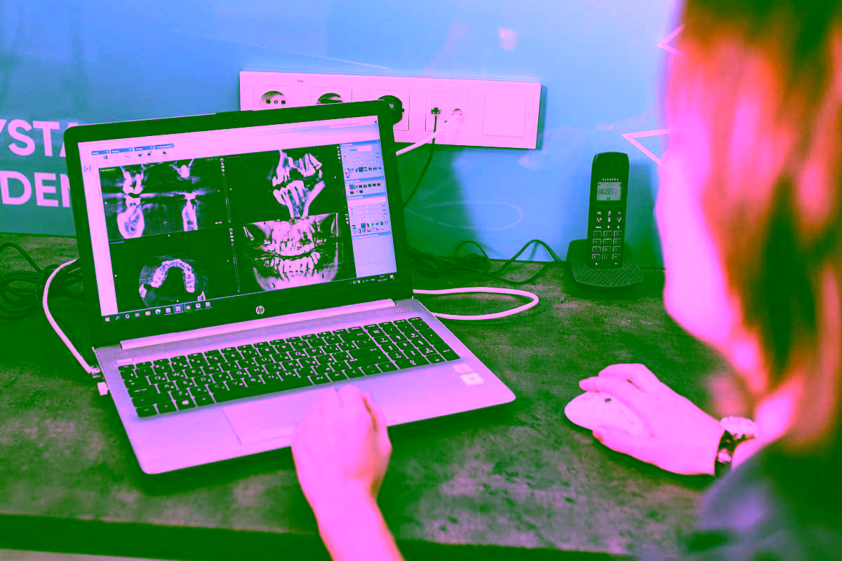 Пластинка на зубы: что это такое, показания, противопоказания к установке, преимущества, недостатки