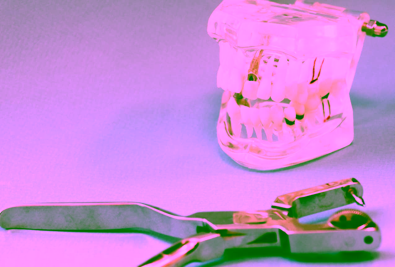 Когда необходима апикальная хирургия? И что это такое