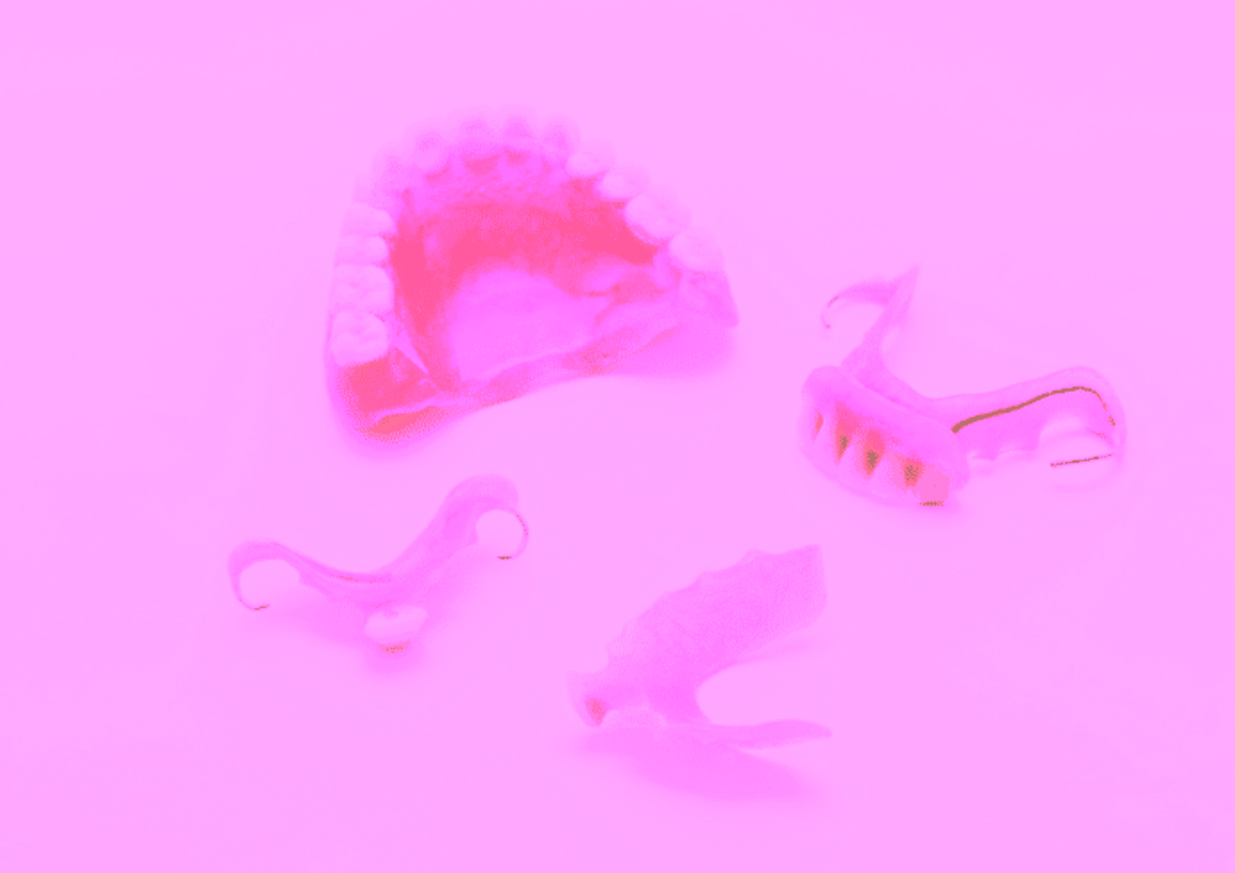 Частичное протезирование зубов