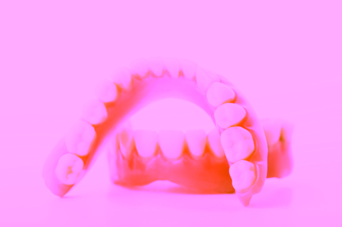 Нейлоновое протезирование зубов