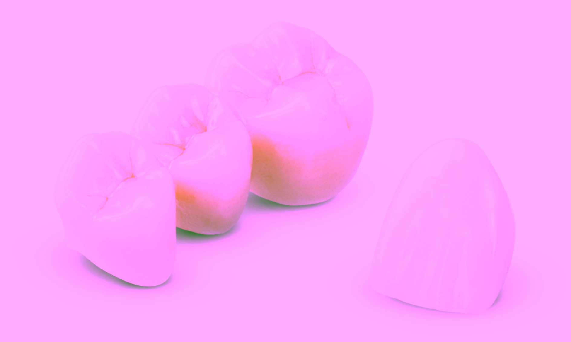 Сколько стоит коронка на зуб