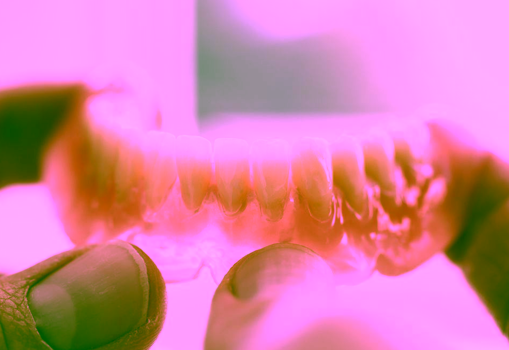 Акриловые зубные протезы