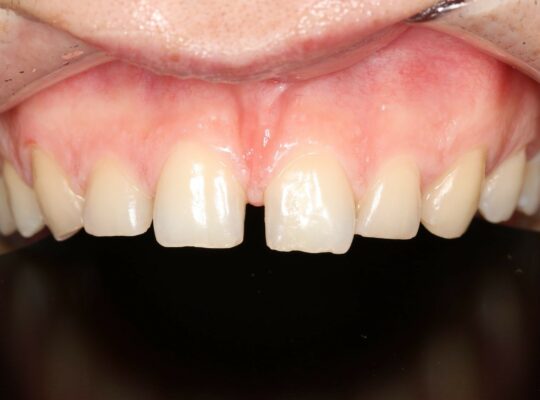 Восстановление Эстетики